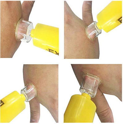 Suction Bee Sting Venom Extractor Pump Kit Emergency Snake Bite Kit 152mm