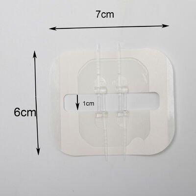 Disposable Emergency wound Closure strips,Pu film strips Can Close The 3cm WoundZip Stitch Wound Closures Device