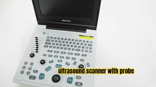 saferlife medical equipment Ultrasound scanner
